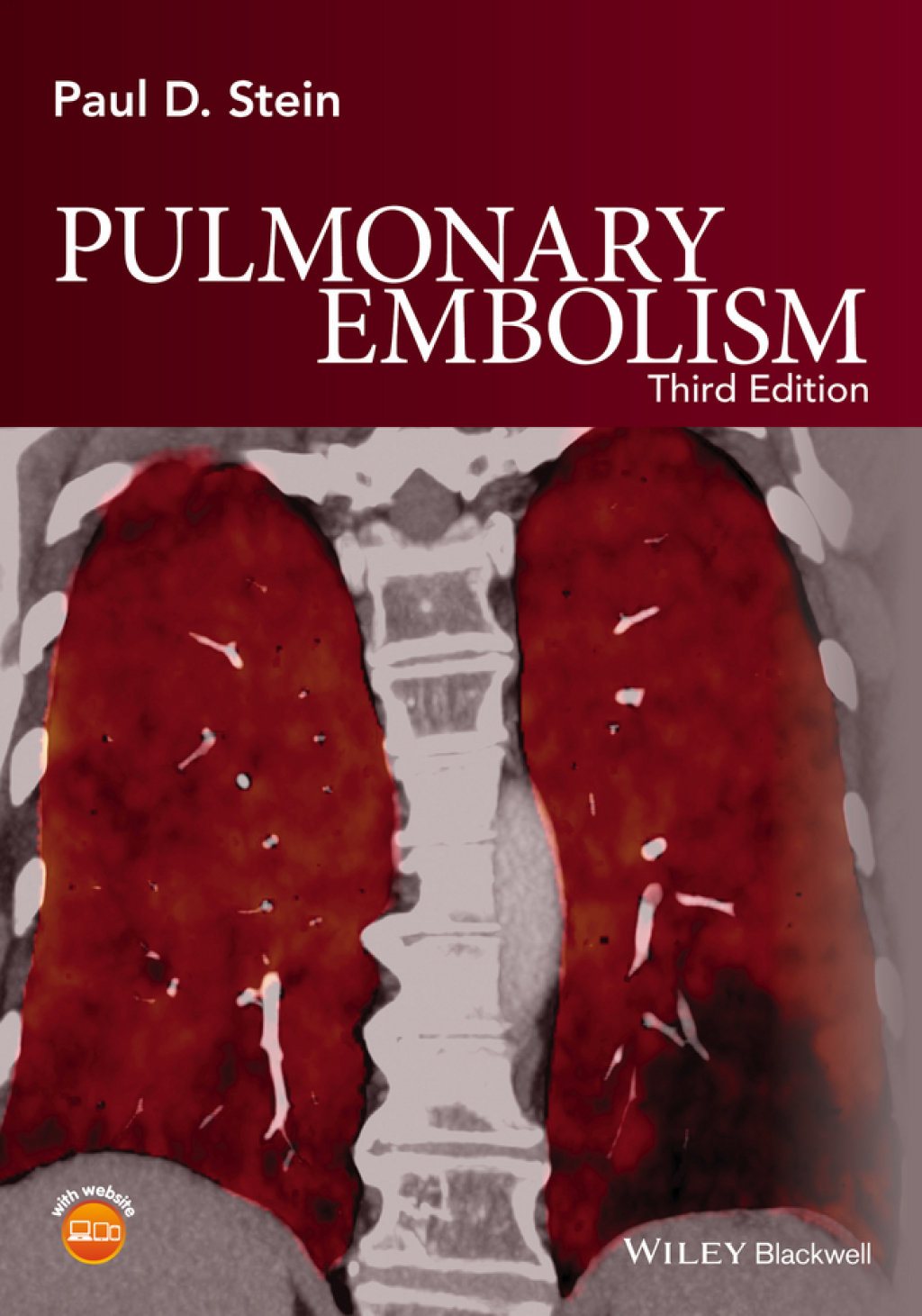 Pulmonary Embolism 3rd Edition â€“ PDF/EPUB Version Downloadable