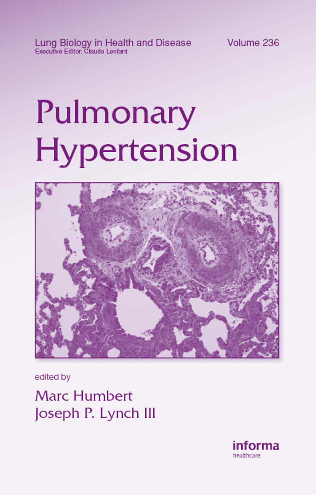 Pulmonary Hypertension 1st Edition â€“ PDF/EPUB Version Downloadable