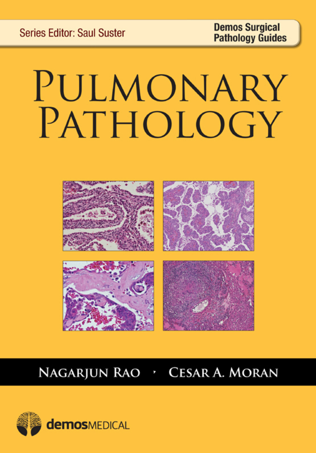Pulmonary Pathology 1st Edition â€“ PDF/EPUB Version Downloadable