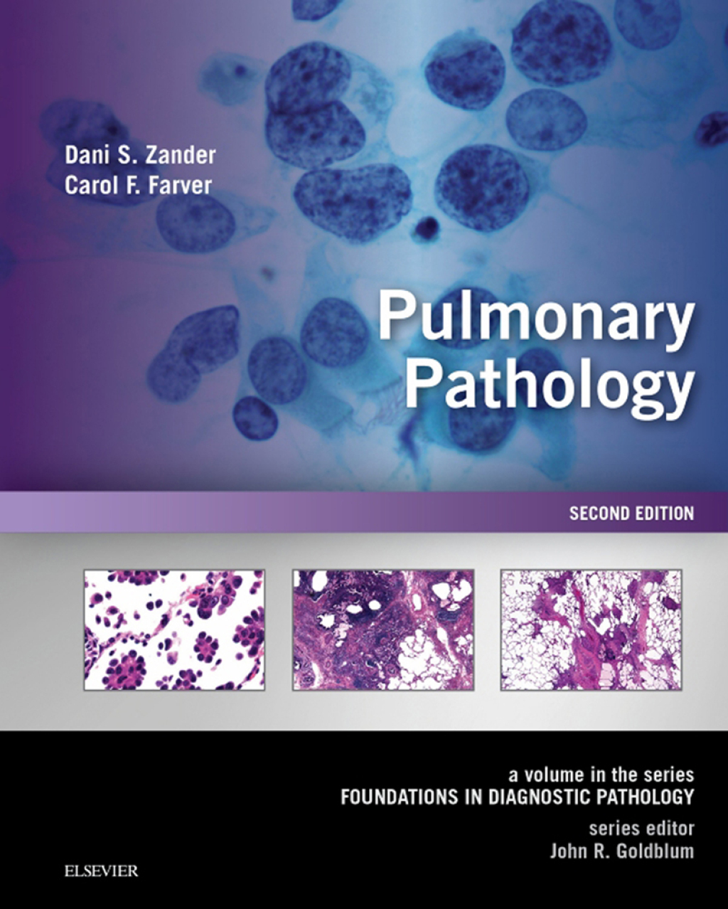 Pulmonary Pathology A Volume in the Series: Foundations in Diagnostic Pathology 2nd Edition â€“ PDF/EPUB Version Downloadable
