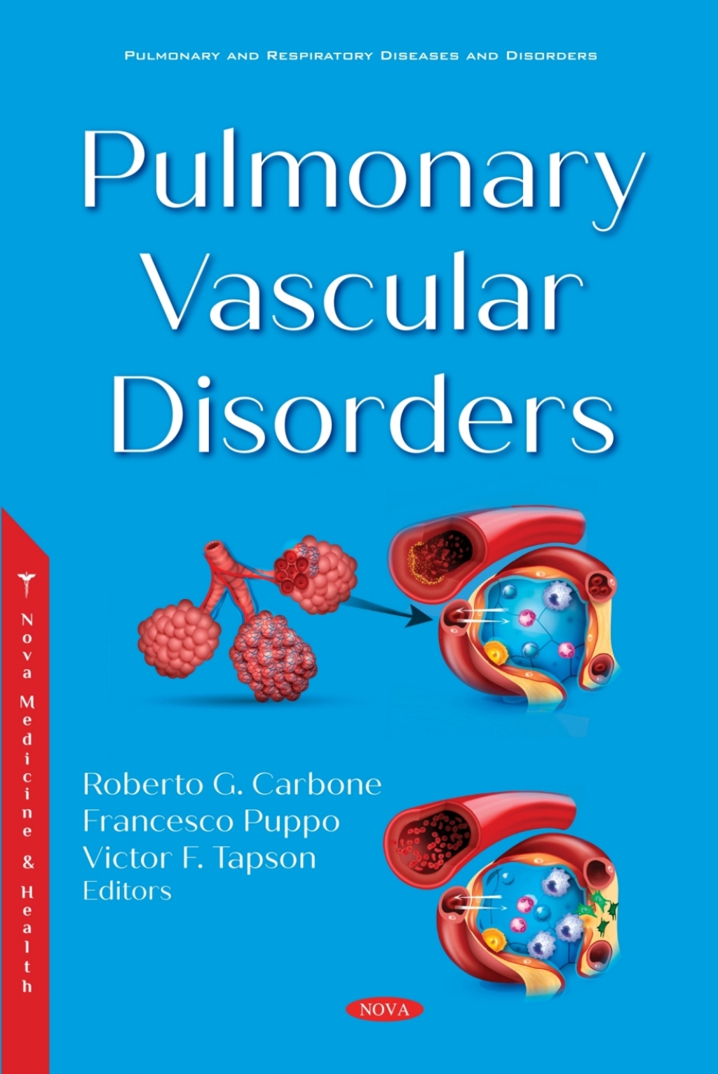 Pulmonary Vascular Disorders  â€“ PDF/EPUB Version Downloadable