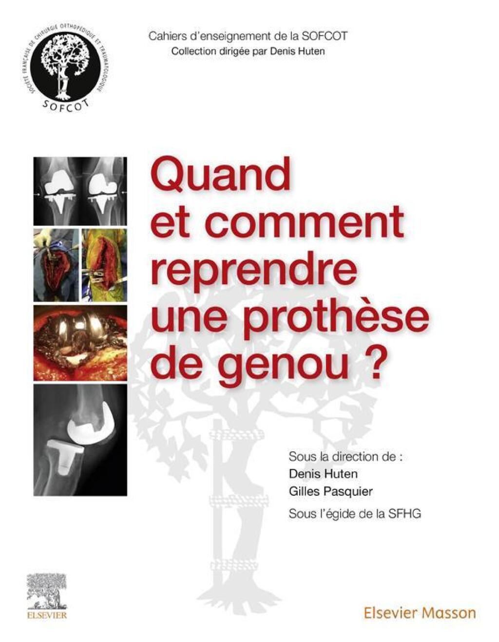 Quand et comment reprendre une prothÃ¨se de genou ? 1st Edition â€“ PDF/EPUB Version Downloadable