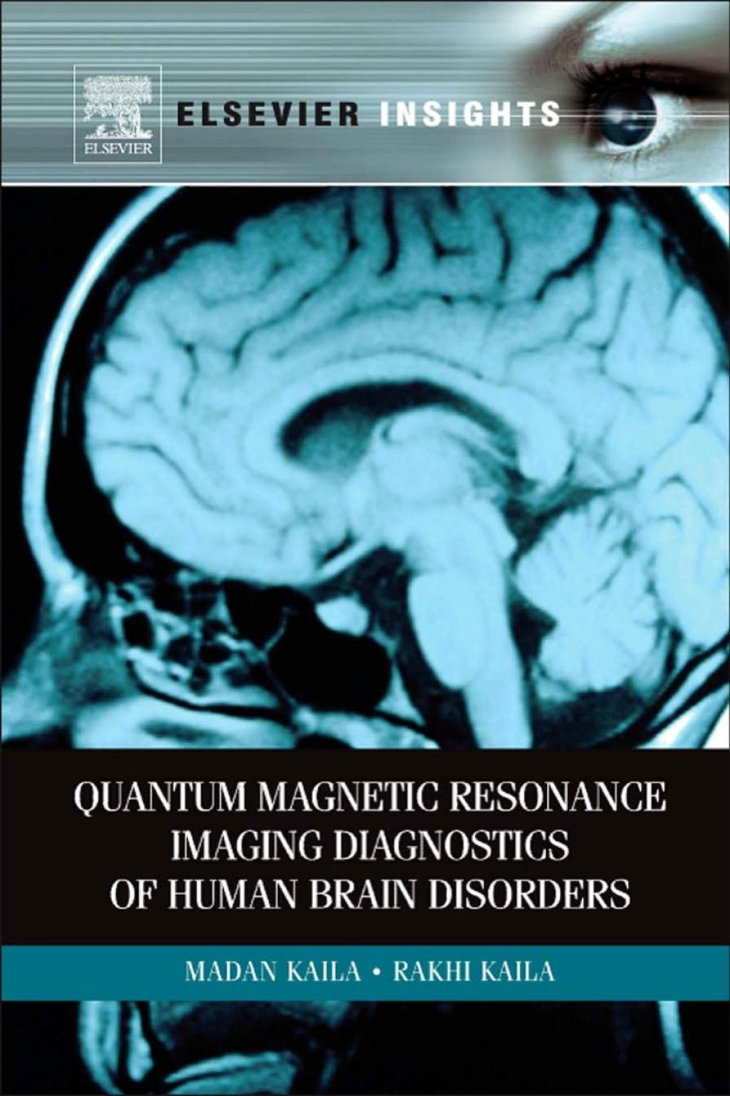Quantum Magnetic Resonance Imaging Diagnostics of Human Brain Disorders  â€“ PDF/EPUB Version Downloadable