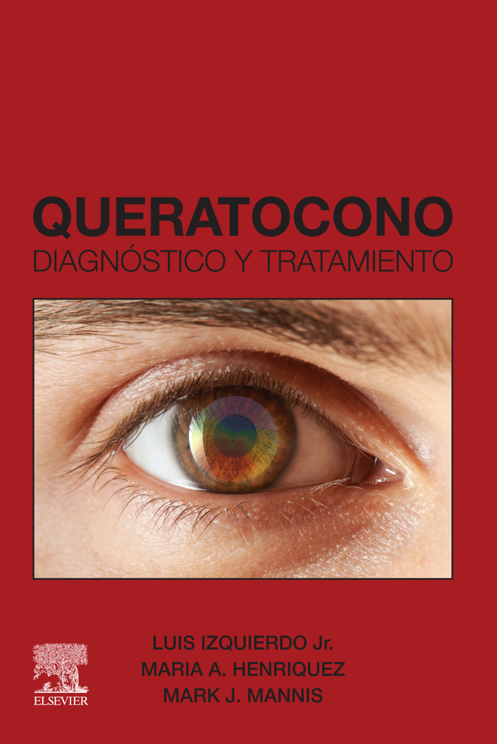 Queratocono DiagnÃ³stico y tratamiento 1st Edition â€“ PDF/EPUB Version Downloadable