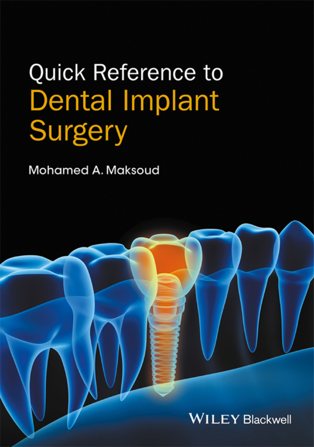 Quick Reference to Dental Implant Surgery 1st Edition â€“ PDF/EPUB Version Downloadable