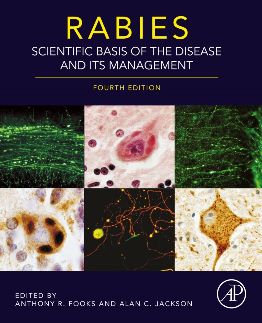Rabies Scientific Basis of the Disease and Its Management 4th Edition â€“ PDF/EPUB Version Downloadable