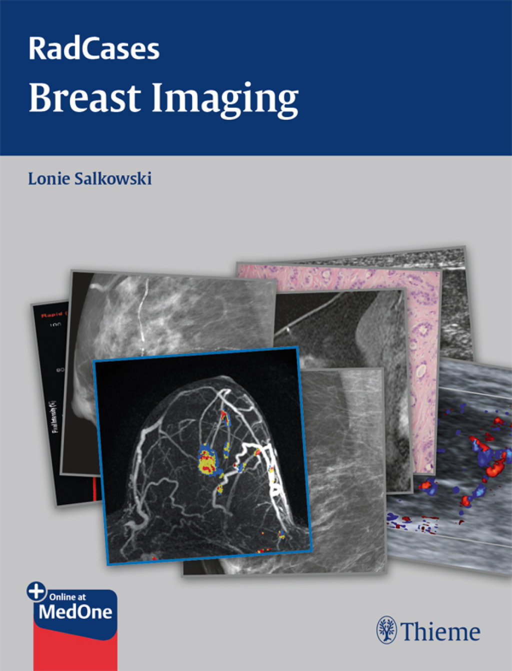 Radcases Breast Imaging 1st Edition â€“ PDF/EPUB Version Downloadable
