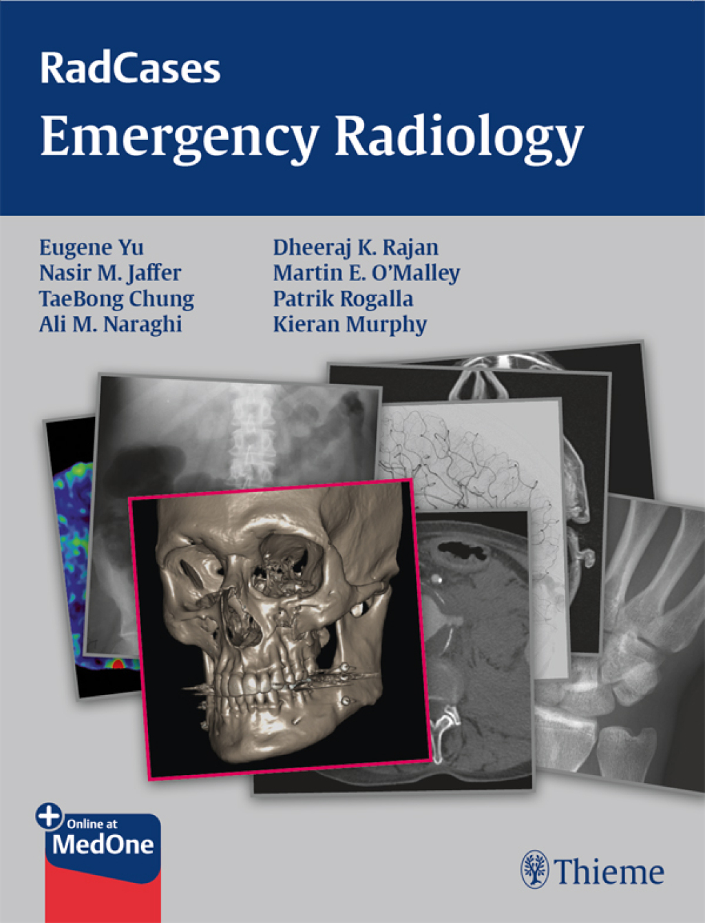 Radcases Emergency Radiology 1st Edition â€“ PDF/EPUB Version Downloadable