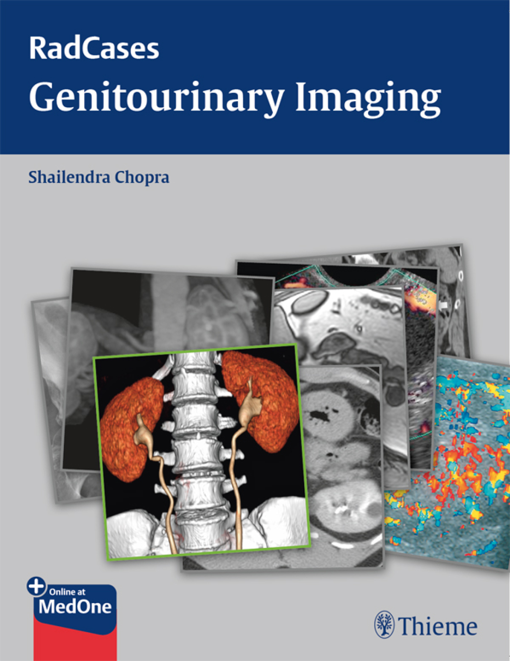 Radcases Genitourinary Imaging 1st Edition â€“ PDF/EPUB Version Downloadable
