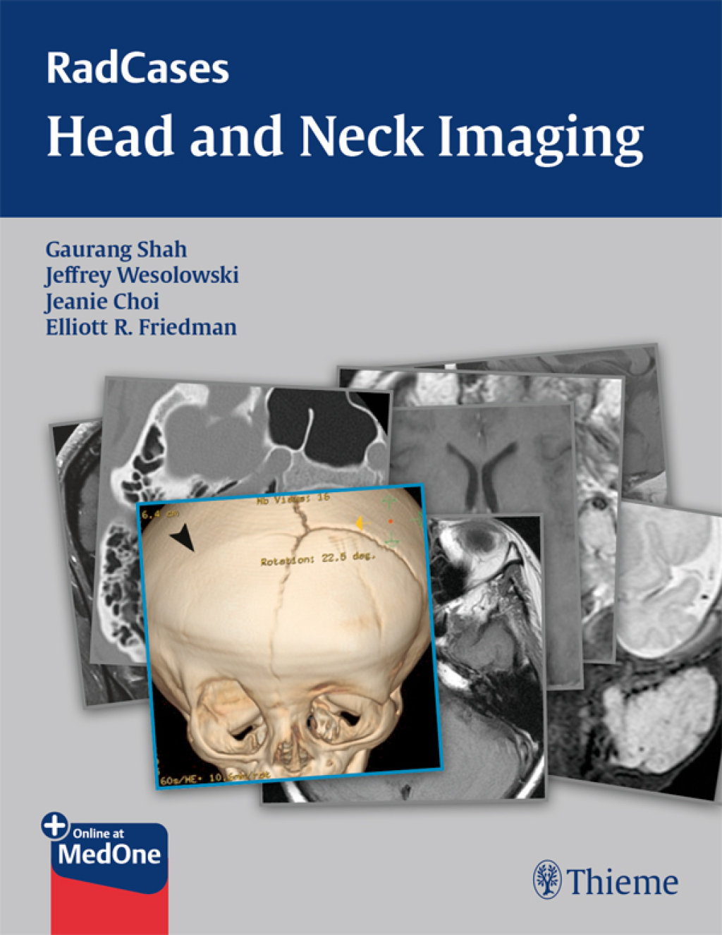 RadCases Head and Neck Imaging 1st Edition â€“ PDF/EPUB Version Downloadable