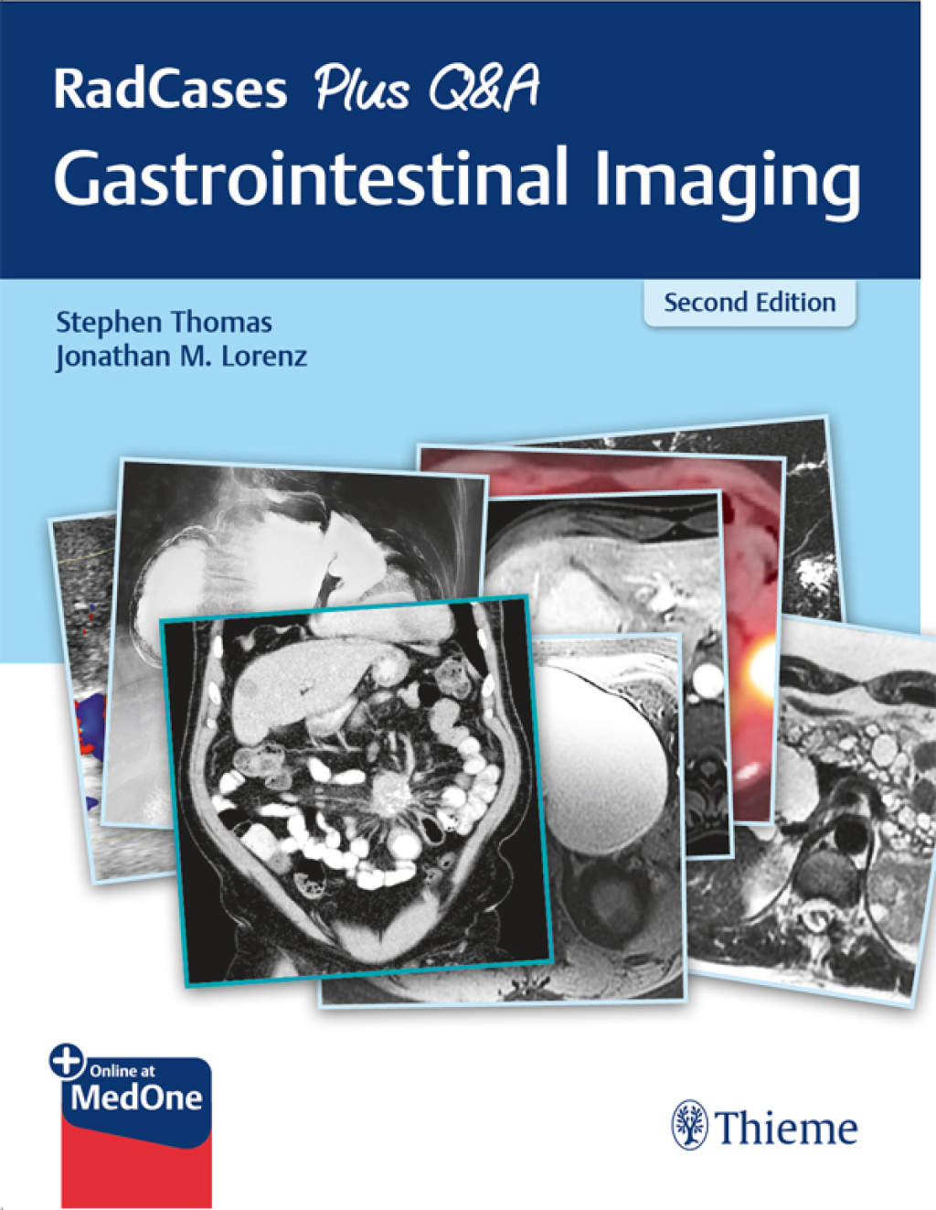 RadCases Plus Q&A Gastrointestinal Imaging 2nd Edition â€“ PDF/EPUB Version Downloadable