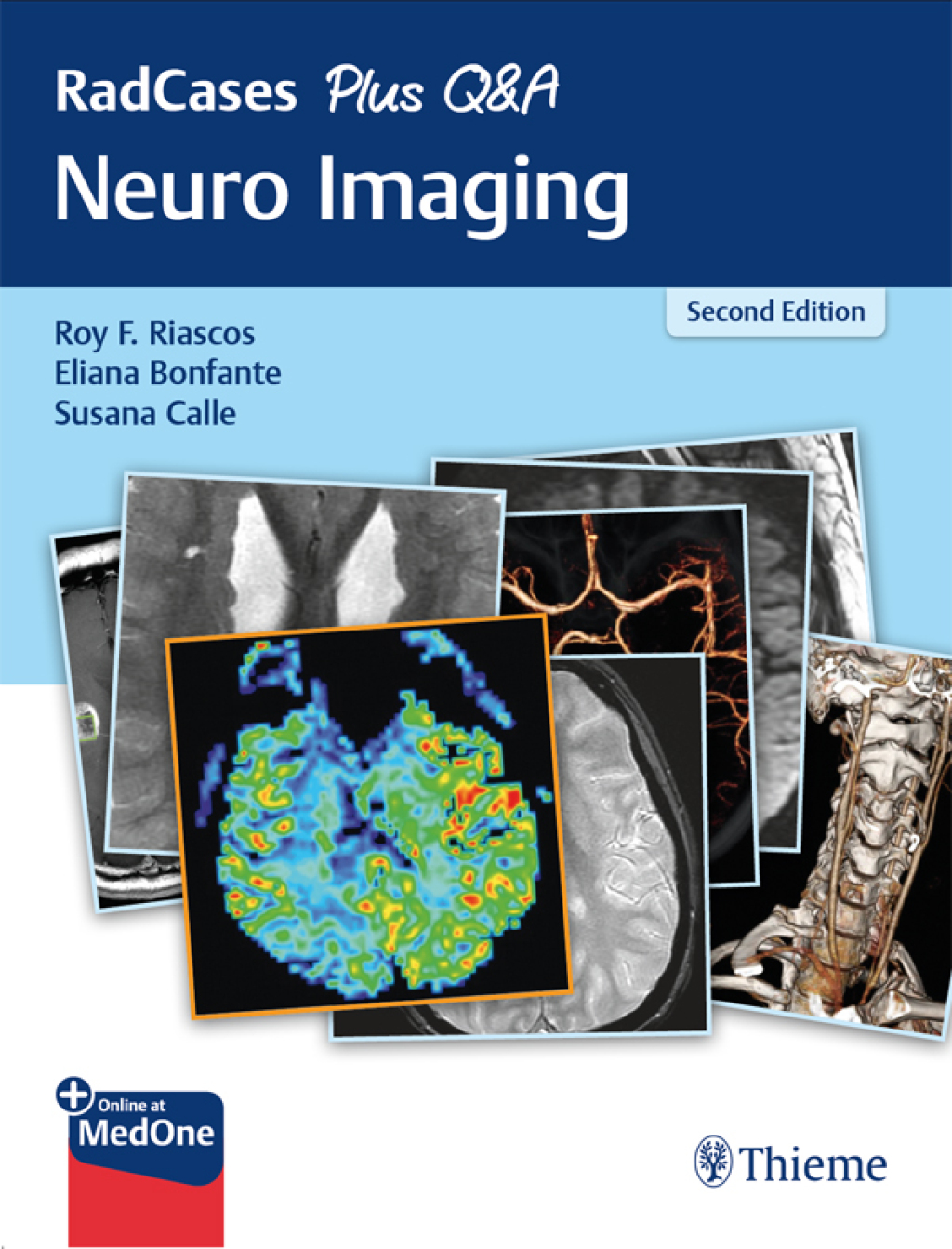 RadCases Plus Q&A Neuro Imaging 2nd Edition â€“ PDF/EPUB Version Downloadable
