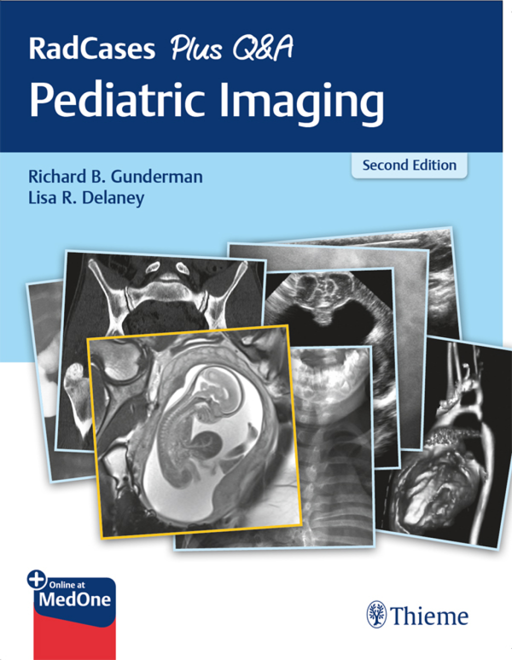 RadCases Plus Q&A Pediatric Imaging 2nd Edition â€“ PDF/EPUB Version Downloadable