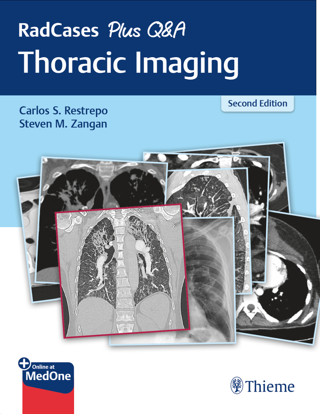 RadCases Plus Q&A Thoracic Imaging 2nd Edition â€“ PDF/EPUB Version Downloadable