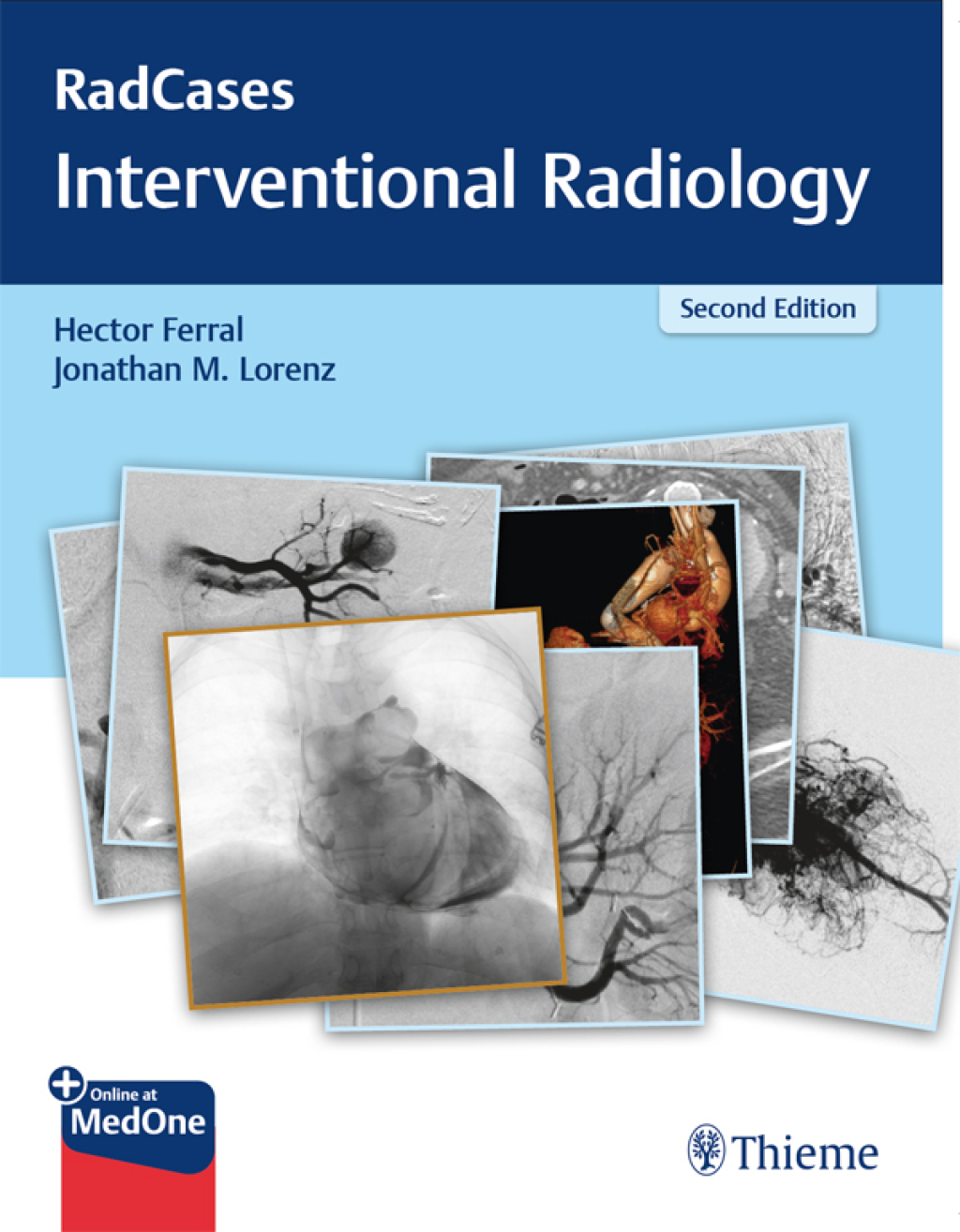 RadCases Q&A Interventional Radiology 2nd Edition â€“ PDF/EPUB Version Downloadable