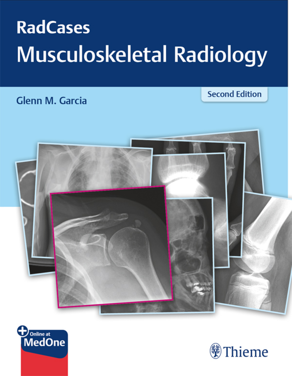 RadCases Q&A Musculoskeletal Radiology 2nd Edition â€“ PDF/EPUB Version Downloadable