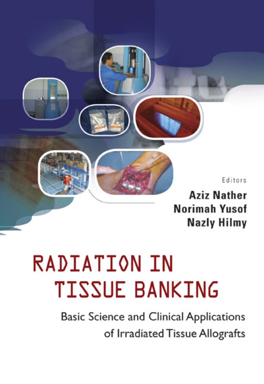 Radiation in Tissue Banking: Basic Science and Clinical Applications of Irradiated Tissue Allografts  â€“ PDF/EPUB Version Downloadable