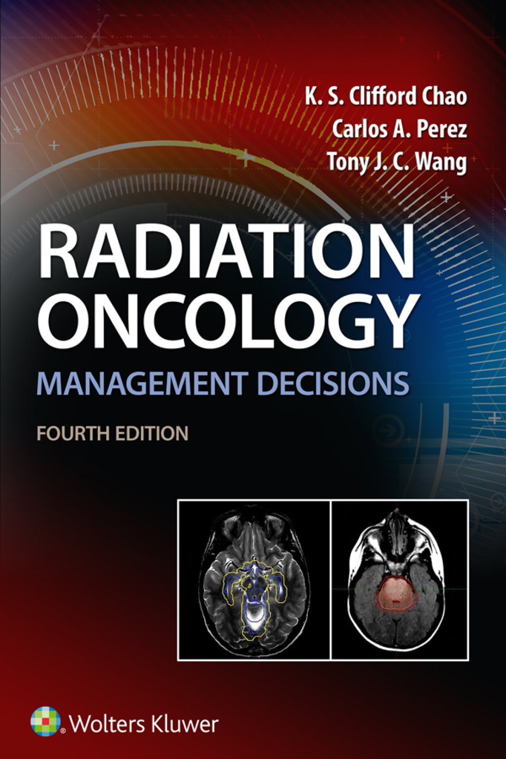 Radiation Oncology Management Decisions 4th Edition â€“ PDF/EPUB Version Downloadable