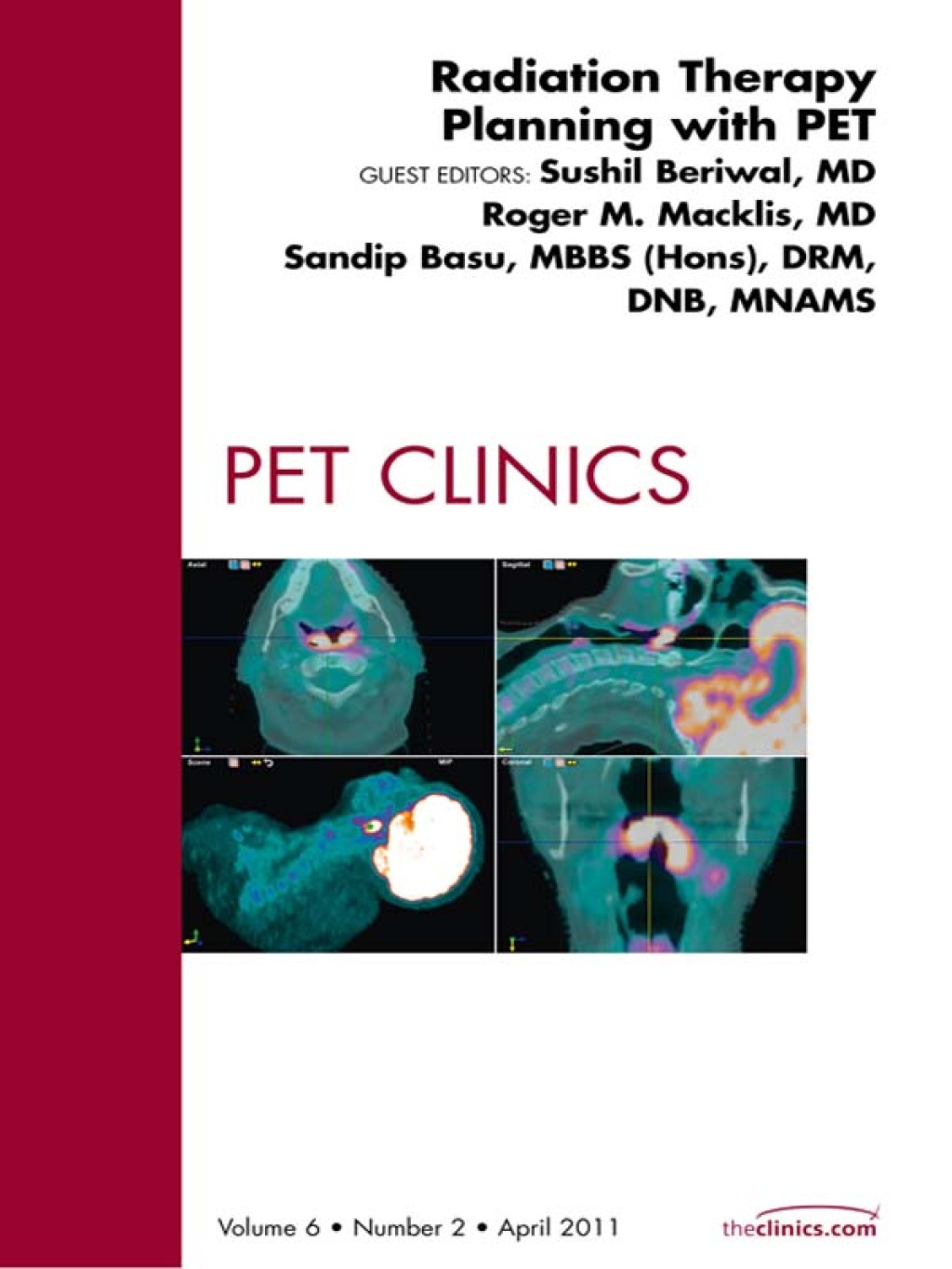 Radiation Therapy Planning, An Issue of PET Clinics  â€“ PDF/EPUB Version Downloadable
