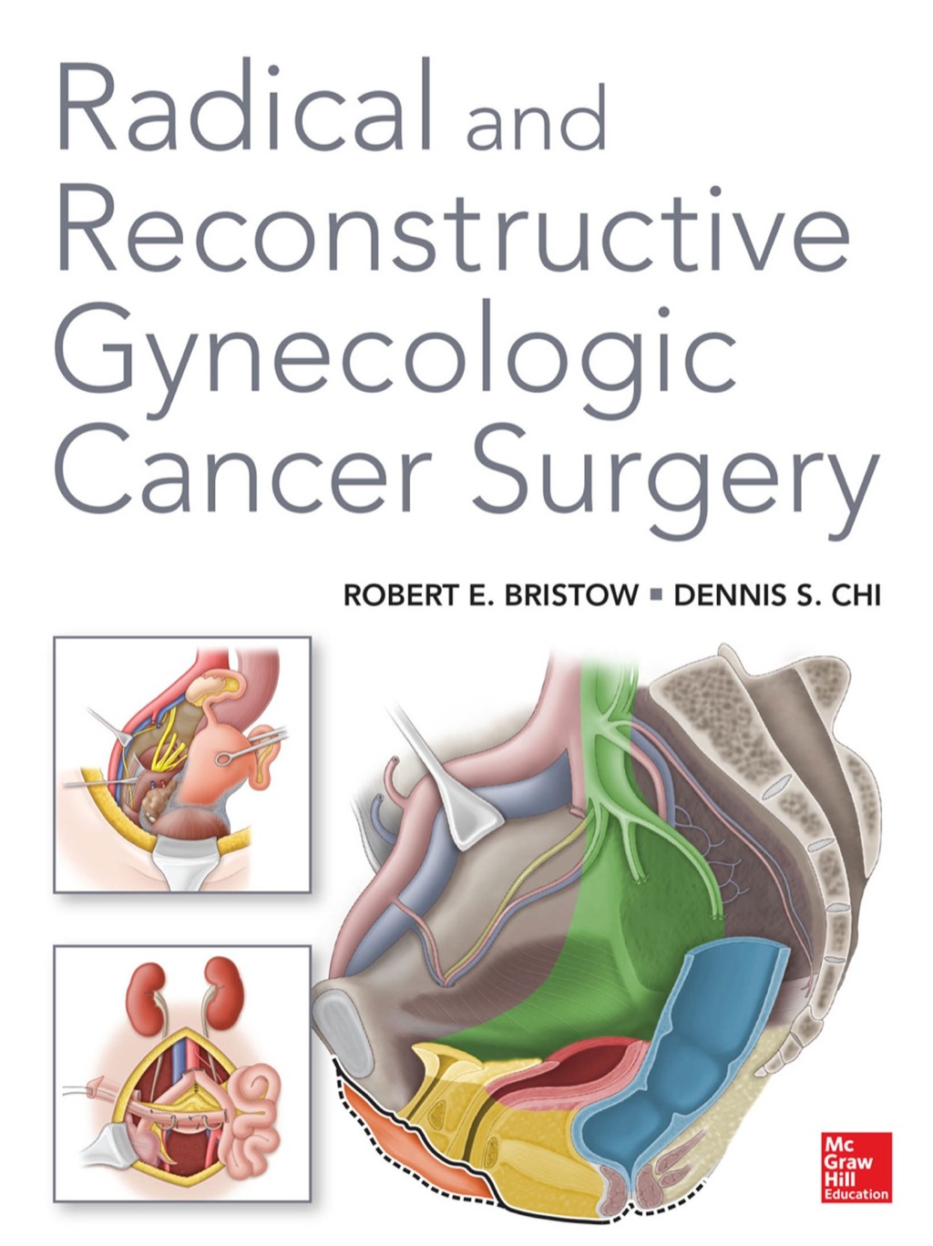Radical and Reconstructive Gynecologic Cancer Surgery 1st Edition â€“ PDF/EPUB Version Downloadable