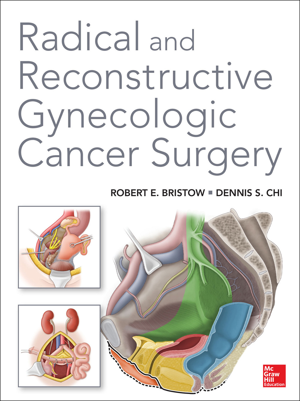 Radical and Reconstructive Gynecologic Cancer Surgery 1st Edition – PDF/EPUB Version Downloadable