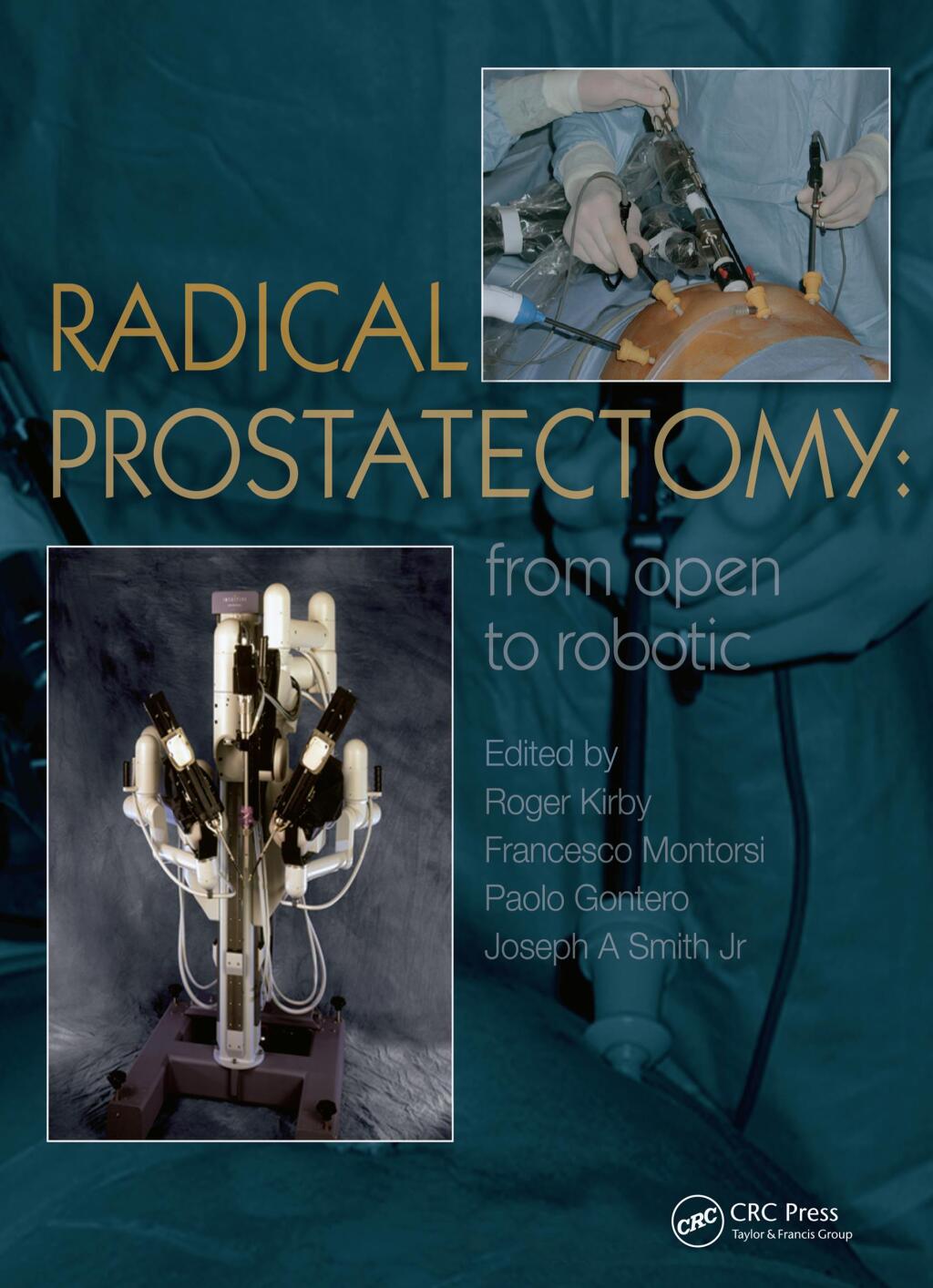 Radical Prostatectomy From Open to Robotic 1st Edition â€“ PDF/EPUB Version Downloadable