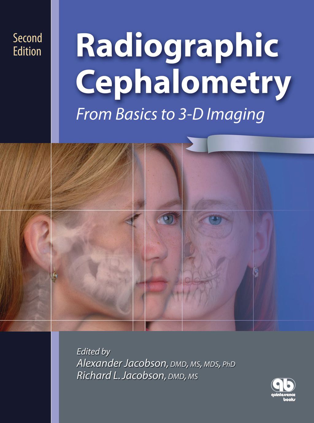 Radiographic Cephalometry 2nd Edition â€“ PDF/EPUB Version Downloadable
