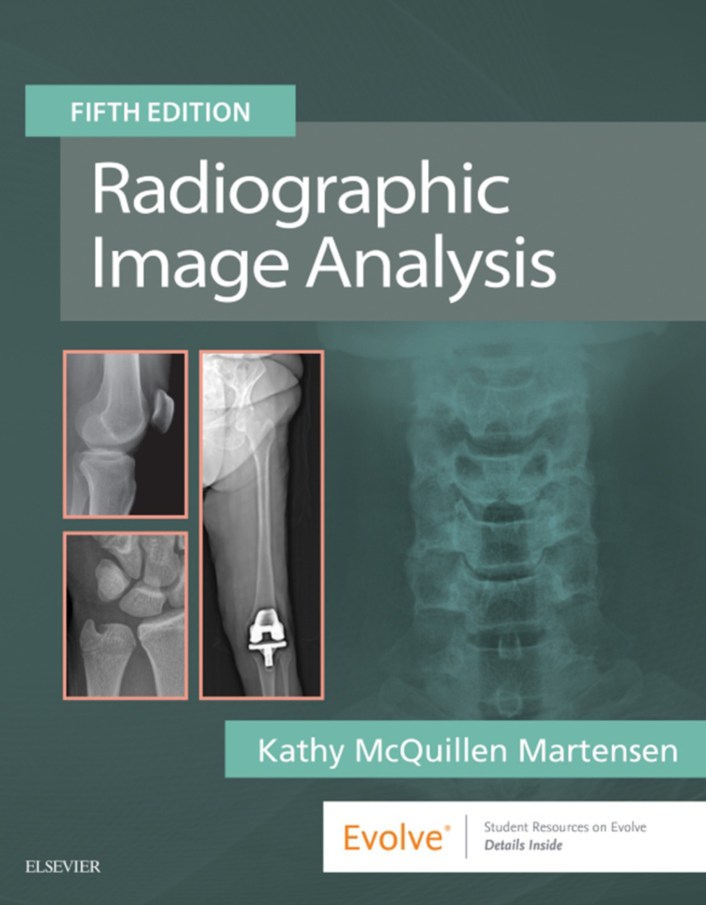 Radiographic Image Analysis 5th Edition â€“ PDF/EPUB Version Downloadable