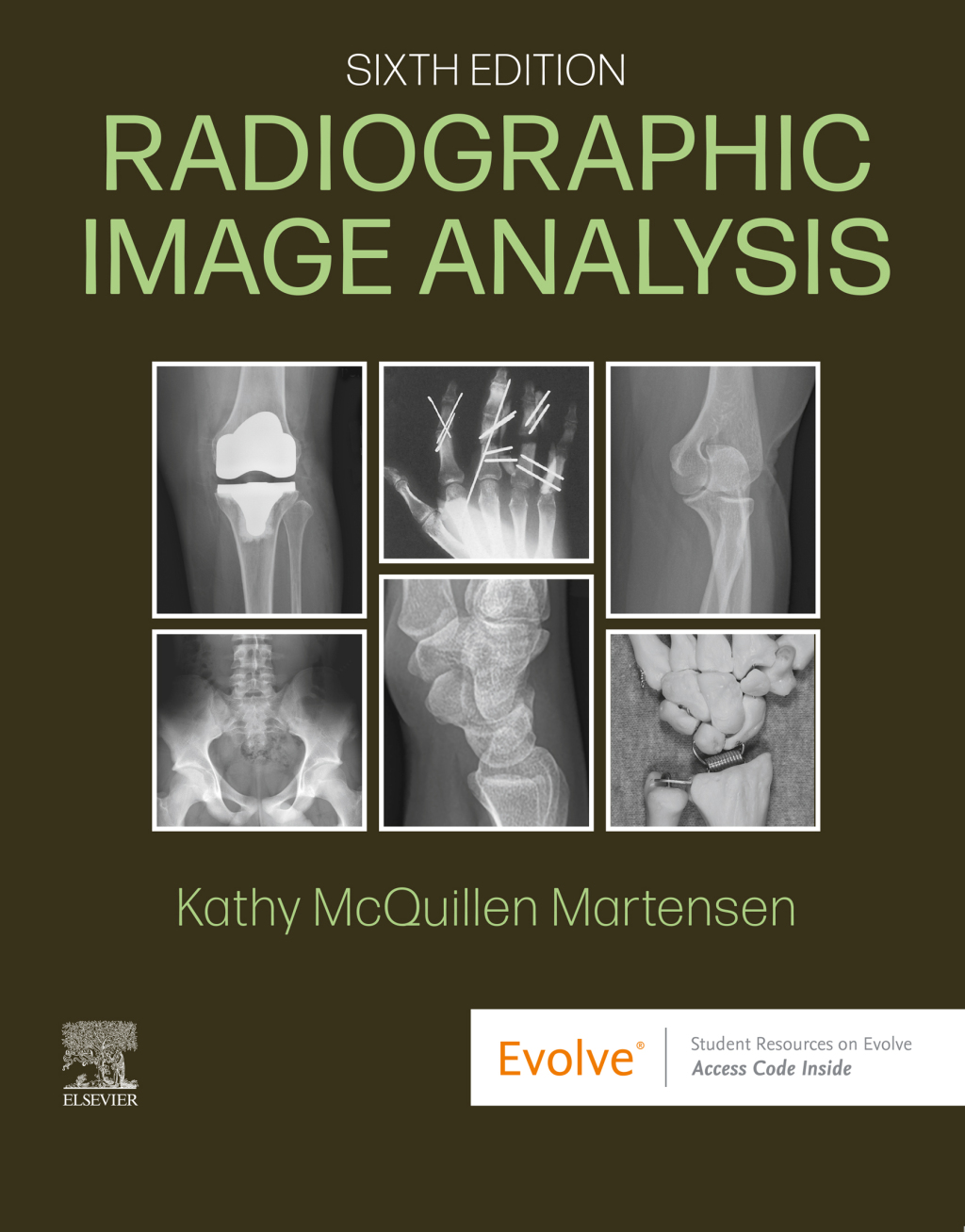 Radiographic Image Analysis 6th Edition â€“ PDF/EPUB Version Downloadable