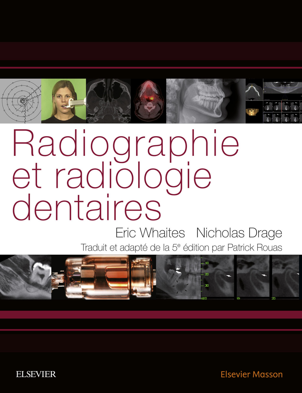 Radiographie et radiologie dentaires  â€“ PDF/EPUB Version Downloadable