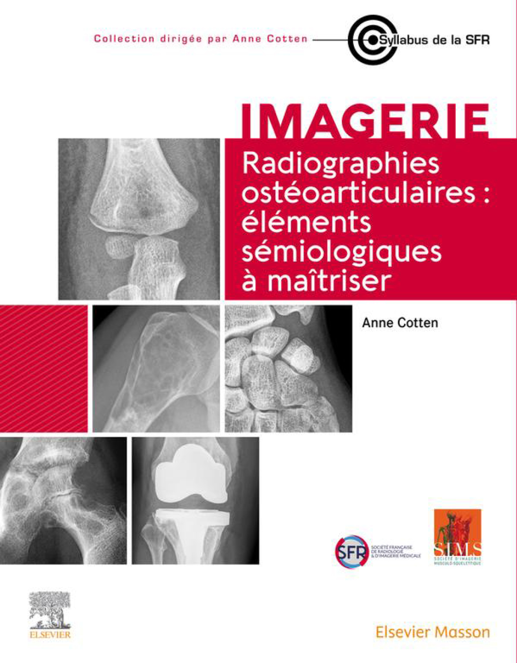 Radiographies ostÃ©oarticulaires : Ã©lÃ©ments sÃ©miologiques Ã  maitriser 1st Edition â€“ PDF/EPUB Version Downloadable