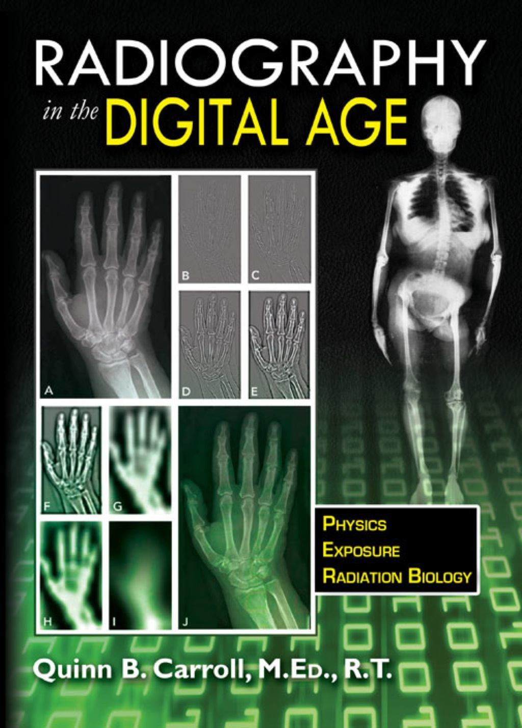 Radiography in the Digital Age: Physics-Exposure-Radiation Biology 1st Edition â€“ PDF/EPUB Version Downloadable