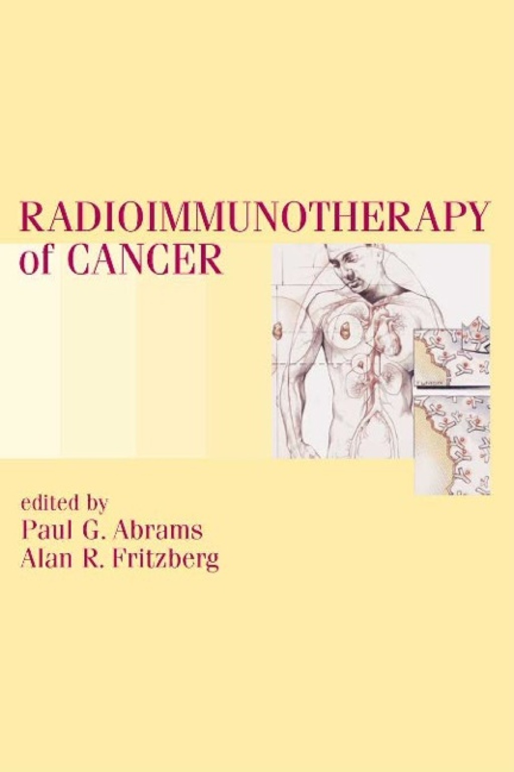 Radioimmunotherapy of Cancer 1st Edition â€“ PDF/EPUB Version Downloadable