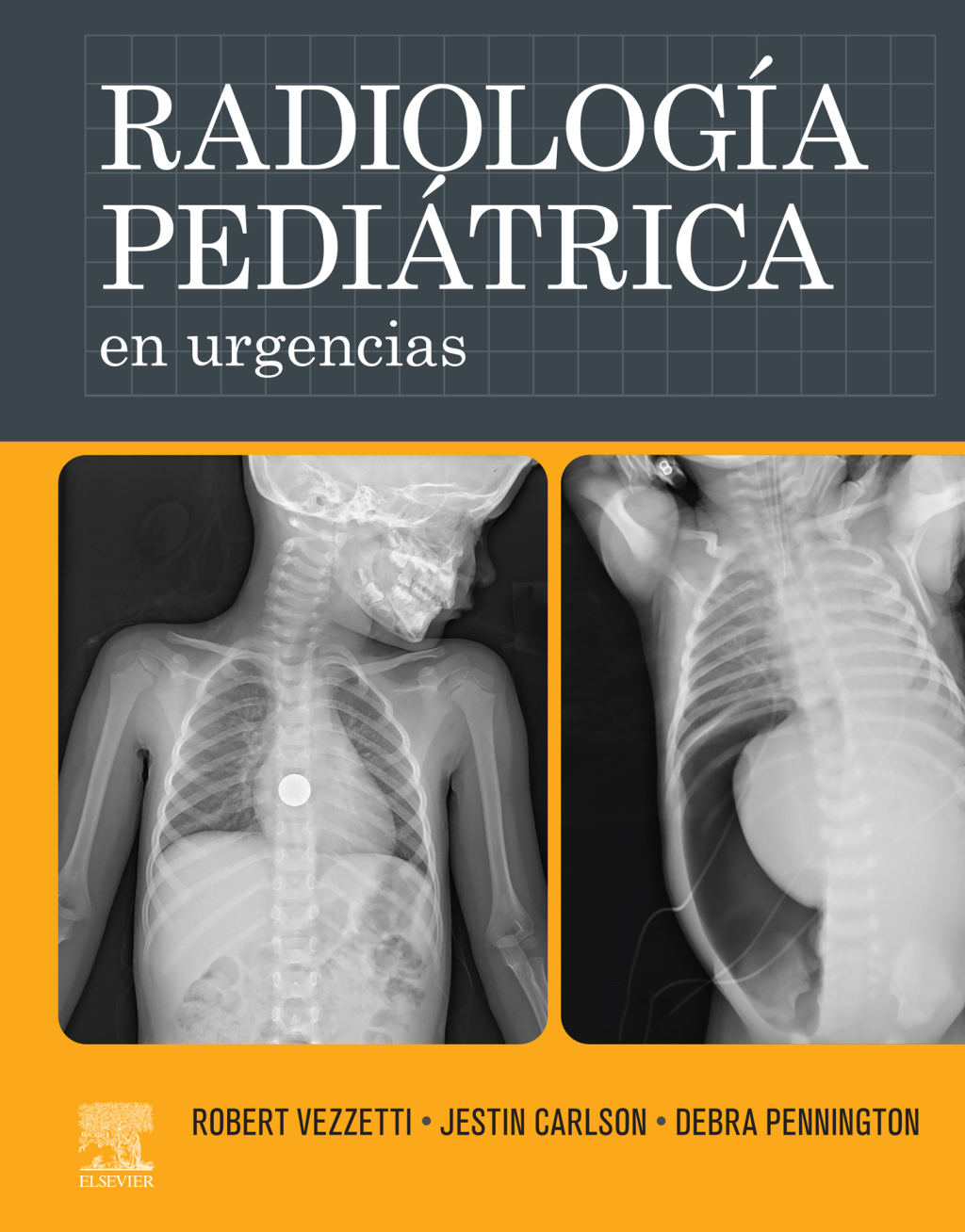RadiologÃ­a pediÃ¡trica en urgencias 1st Edition â€“ PDF/EPUB Version Downloadable