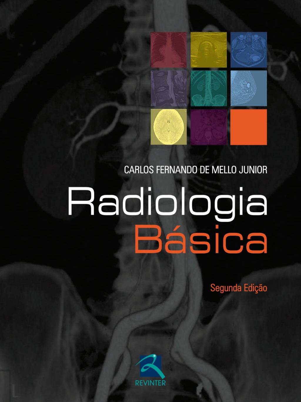 Radiologia BÃ¡sica 2nd Edition â€“ PDF/EPUB Version Downloadable