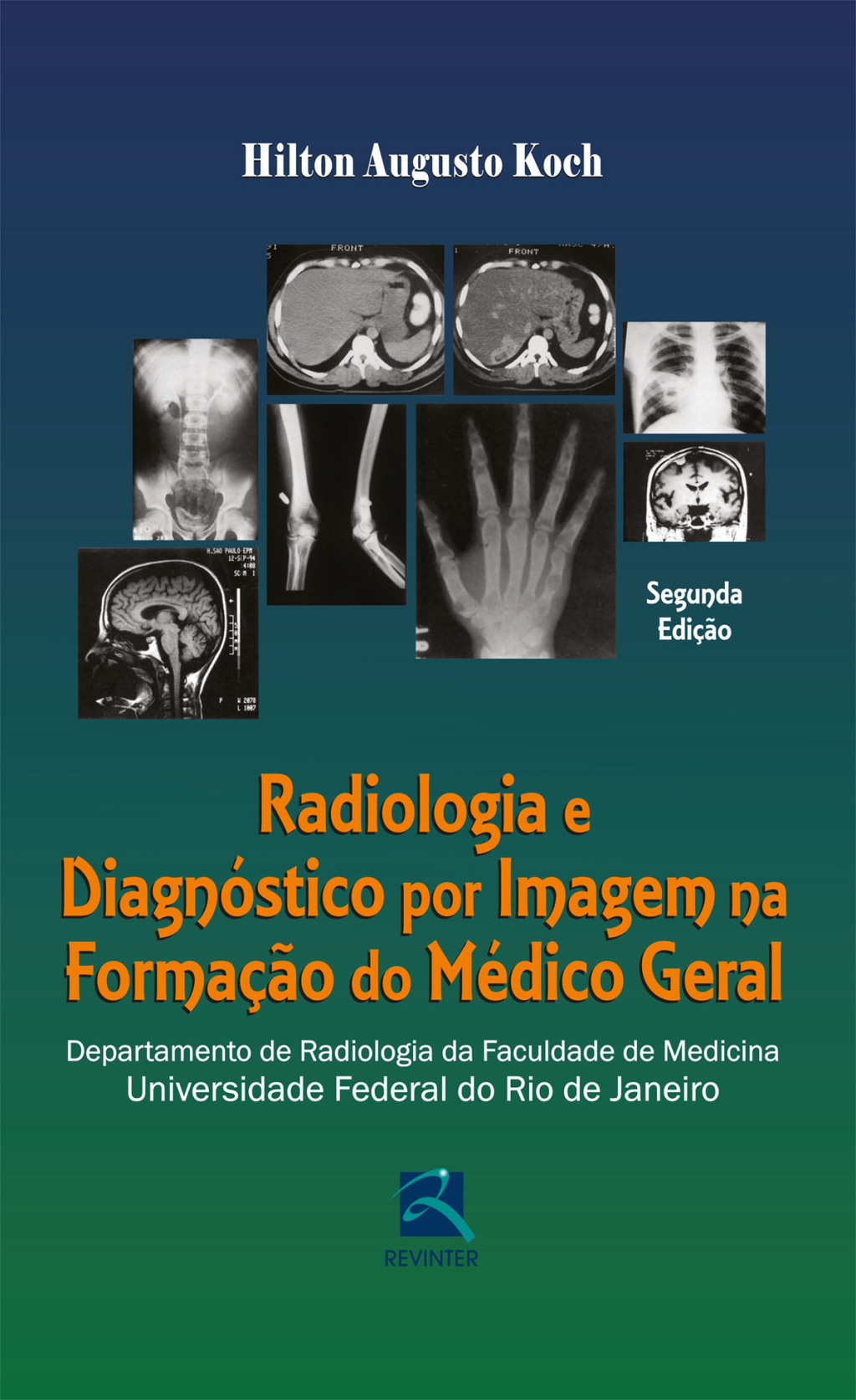 Radiologia e diagnÃ³stico por imagem na formaÃ§Ã£o do mÃ©dico geral 2nd Edition â€“ PDF/EPUB Version Downloadable