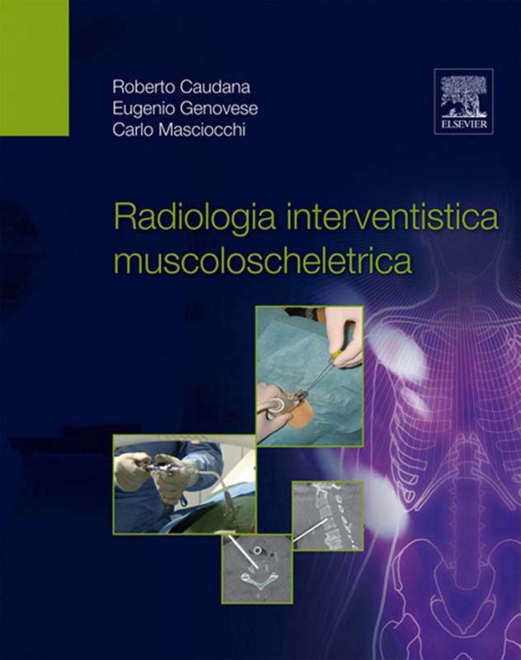Radiologia interventistica muscoloscheletrica  â€“ PDF/EPUB Version Downloadable
