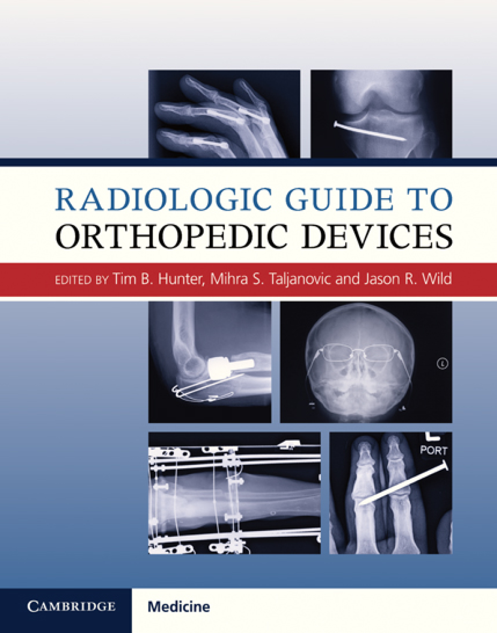 Radiologic Guide to Orthopedic Devices  â€“ PDF/EPUB Version Downloadable