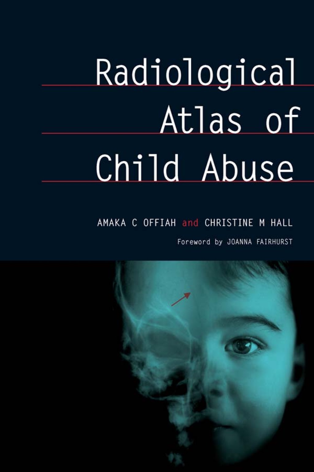 Radiological Atlas of Child Abuse A Complete Resource for MCQs, v. 1 1st Edition â€“ PDF/EPUB Version Downloadable