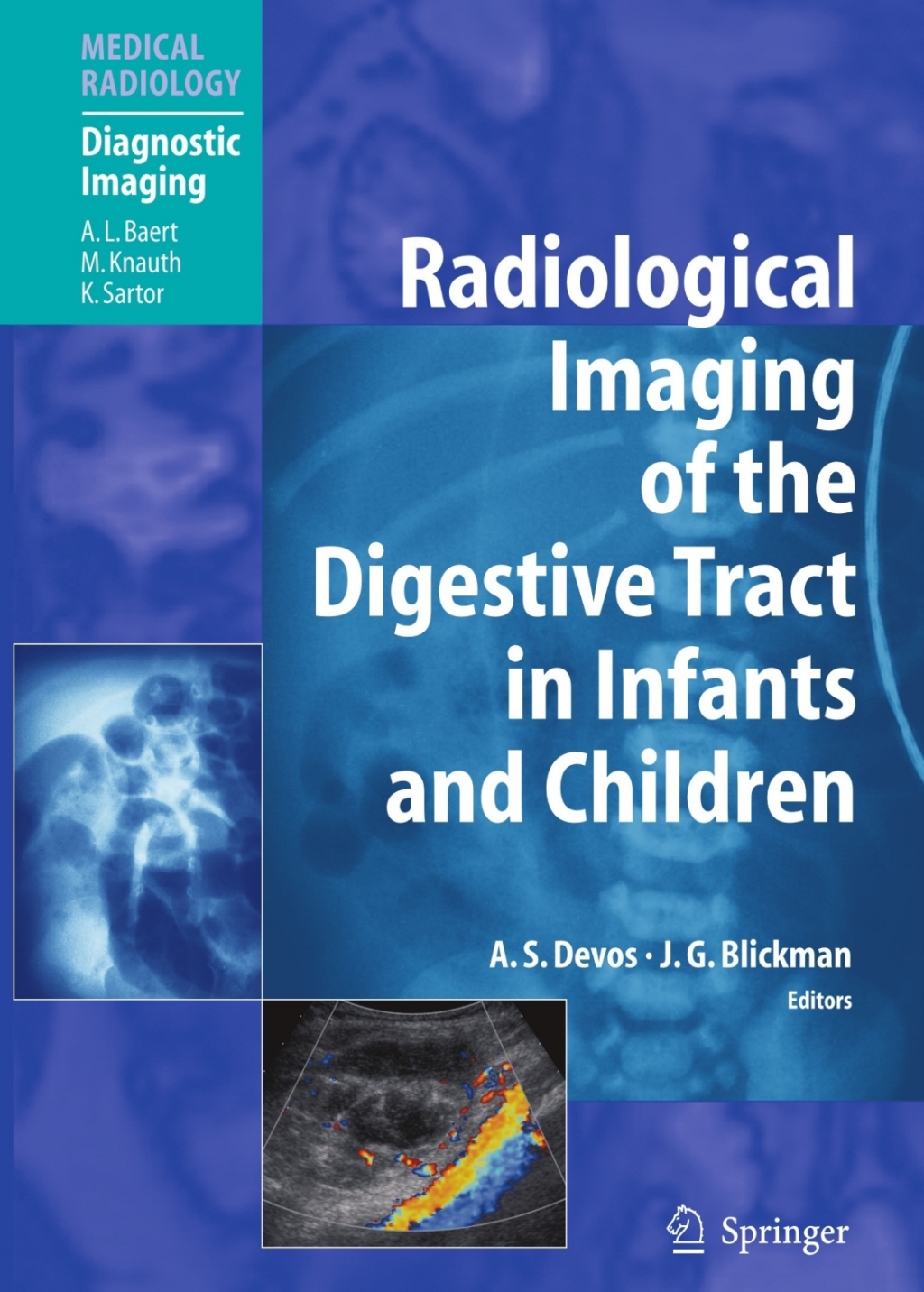 Radiological Imaging of the Digestive Tract in Infants and Children 1st Edition â€“ PDF/EPUB Version Downloadable