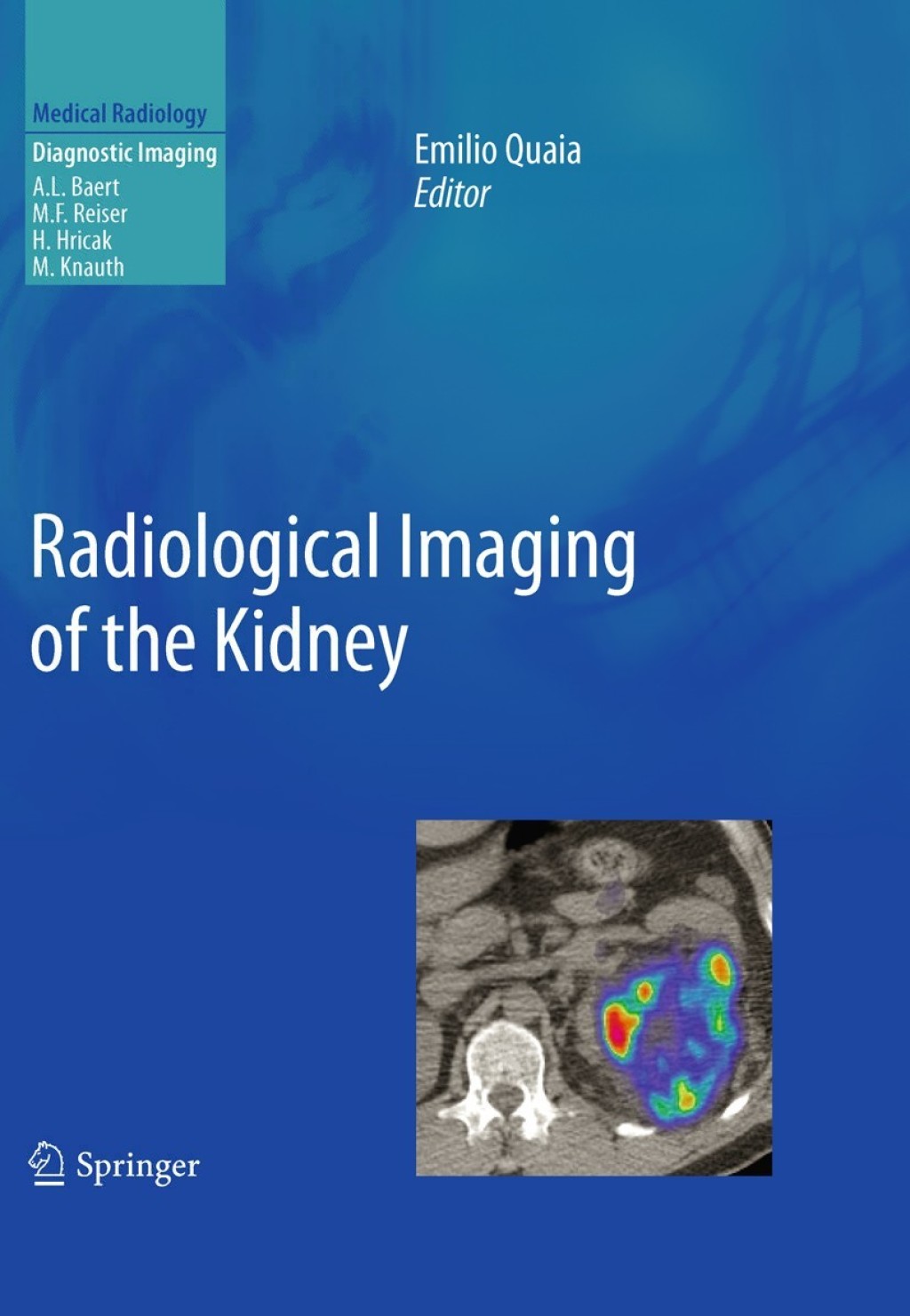Radiological Imaging of the Kidney 1st Edition â€“ PDF/EPUB Version Downloadable