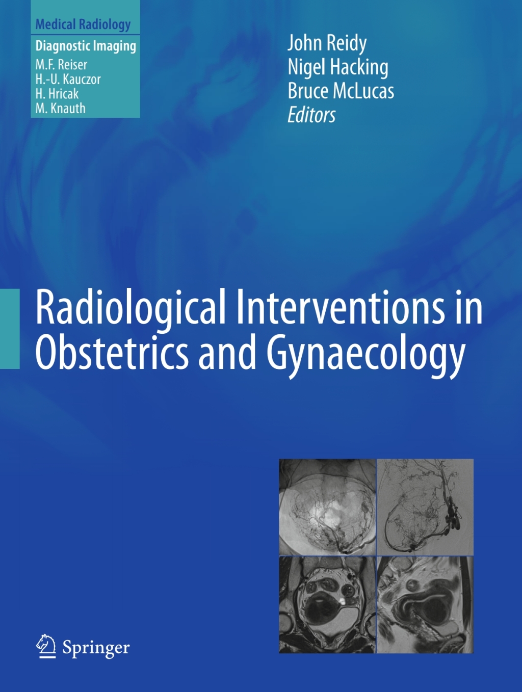 Radiological Interventions in Obstetrics and Gynaecology  â€“ PDF/EPUB Version Downloadable