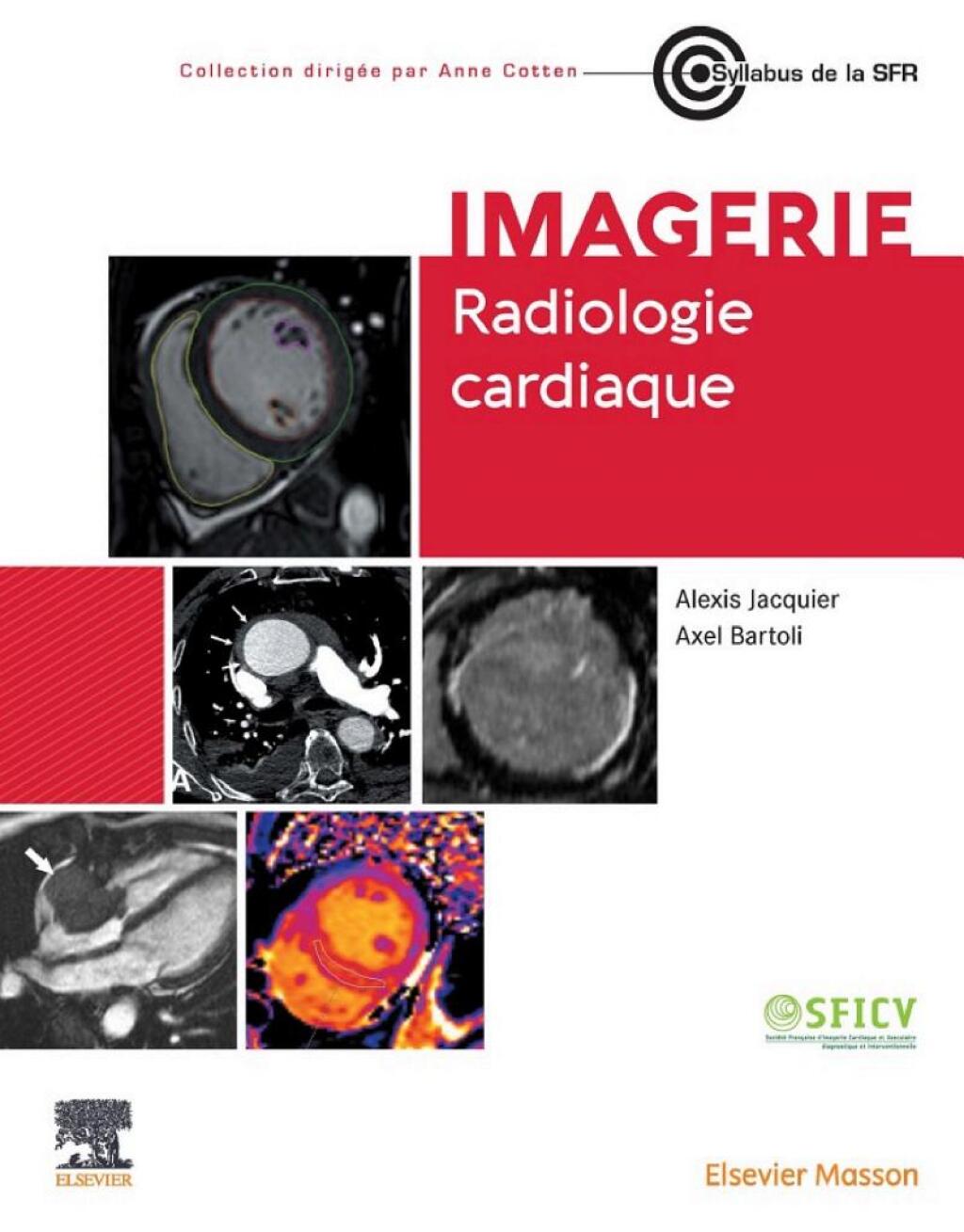 Radiologie cardiaque  â€“ PDF/EPUB Version Downloadable