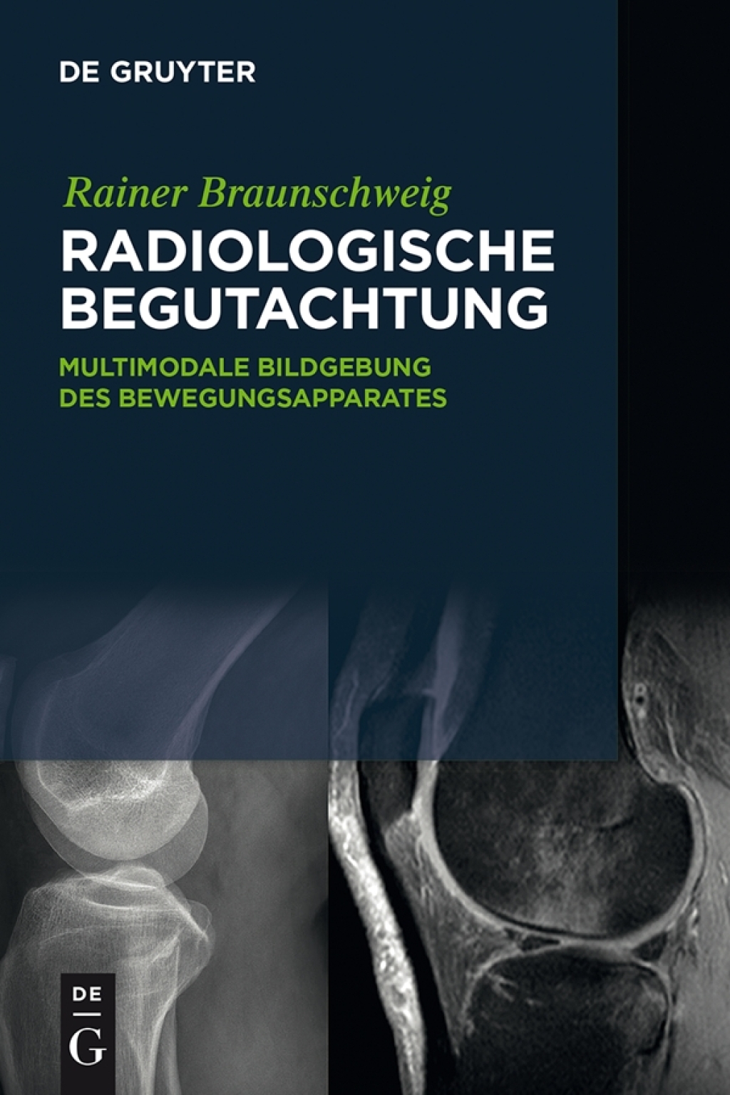 Radiologische Begutachtung Multimodale Bildgebung des Bewegungsapparates 1st Edition â€“ PDF/EPUB Version Downloadable