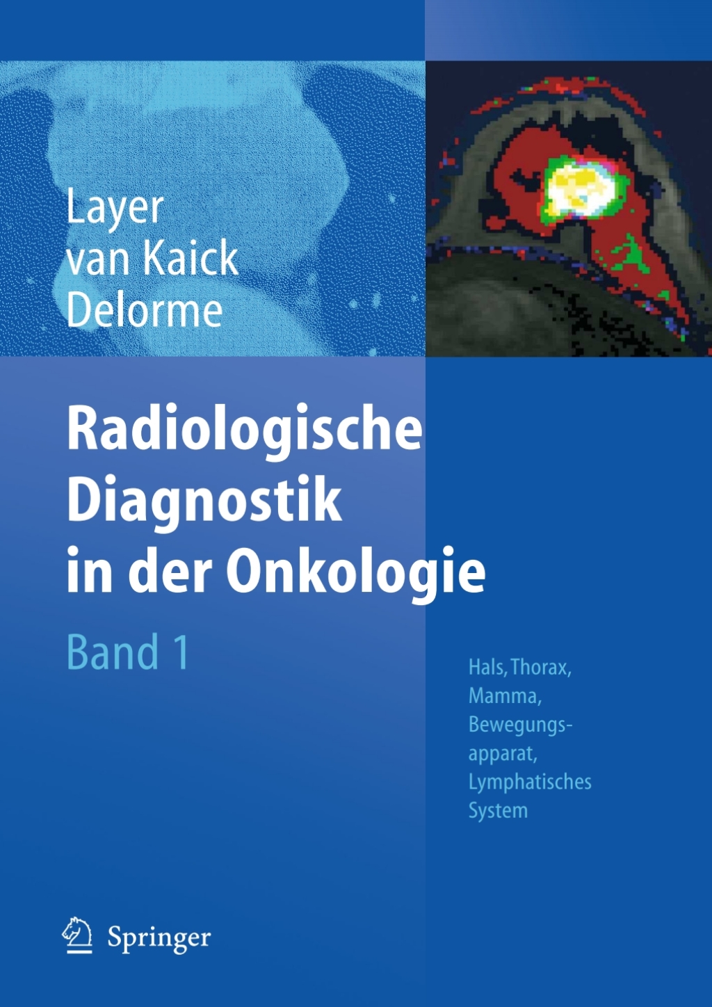 Radiologische Diagnostik in der Onkologie Band 1: Hals, Thorax, Mamma, Bewegungsapparat, Lymphatisches System 1st Edition â€“ PDF/EPUB Version Downloadable