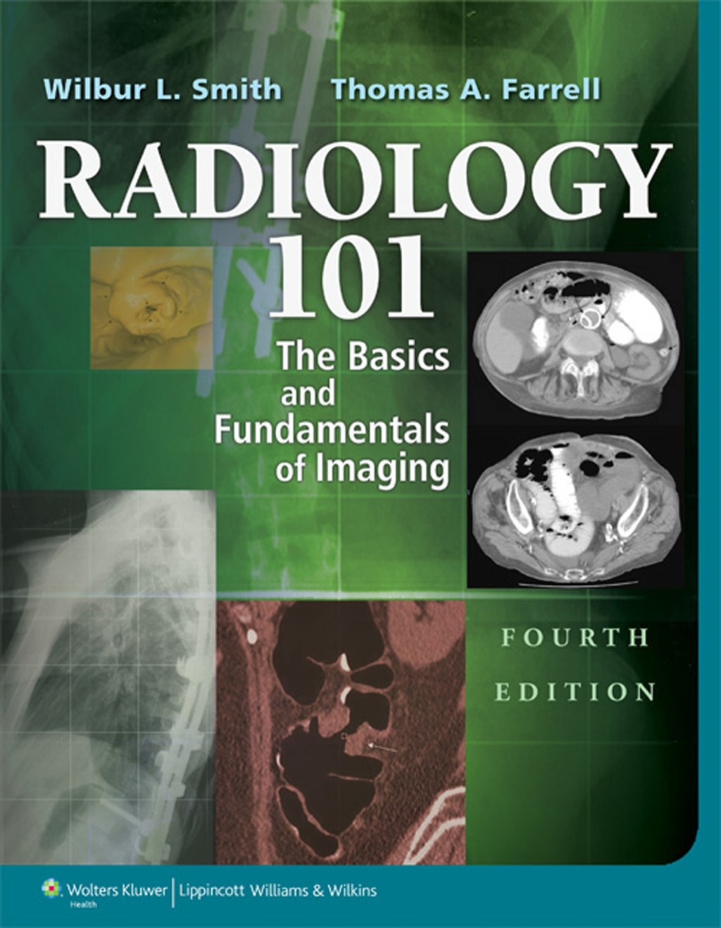 Radiology 101: The Basics & Fundamentals of Imaging 4th Edition â€“ PDF/EPUB Version Downloadable