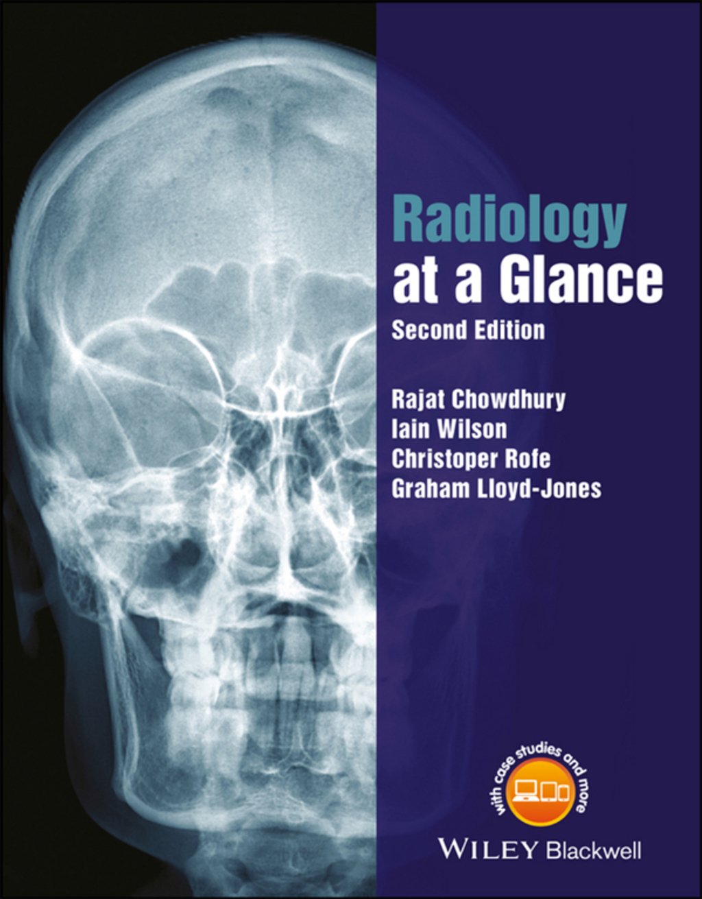 Radiology at a Glance 2nd Edition â€“ PDF/EPUB Version Downloadable