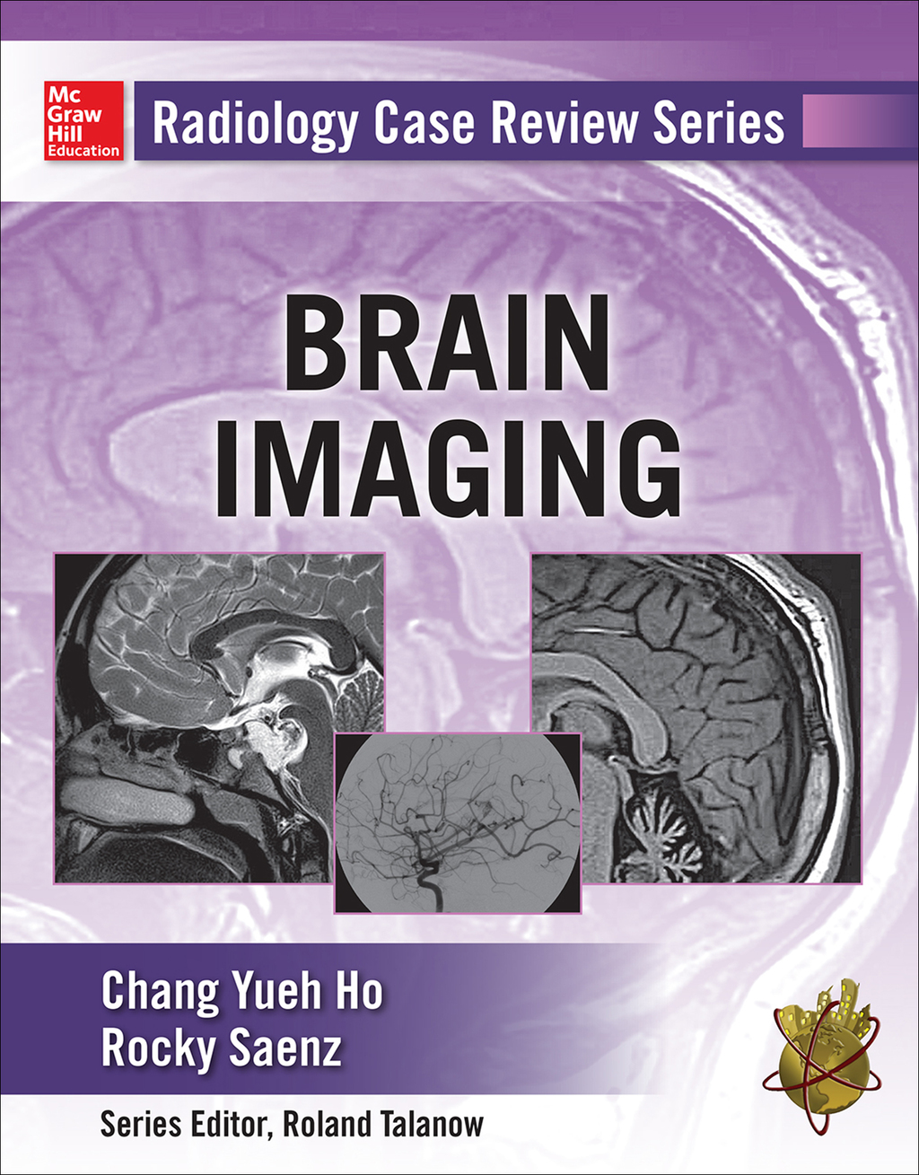 Radiology Case Review Series: Brain Imaging 1st Edition â€“ PDF/EPUB Version Downloadable
