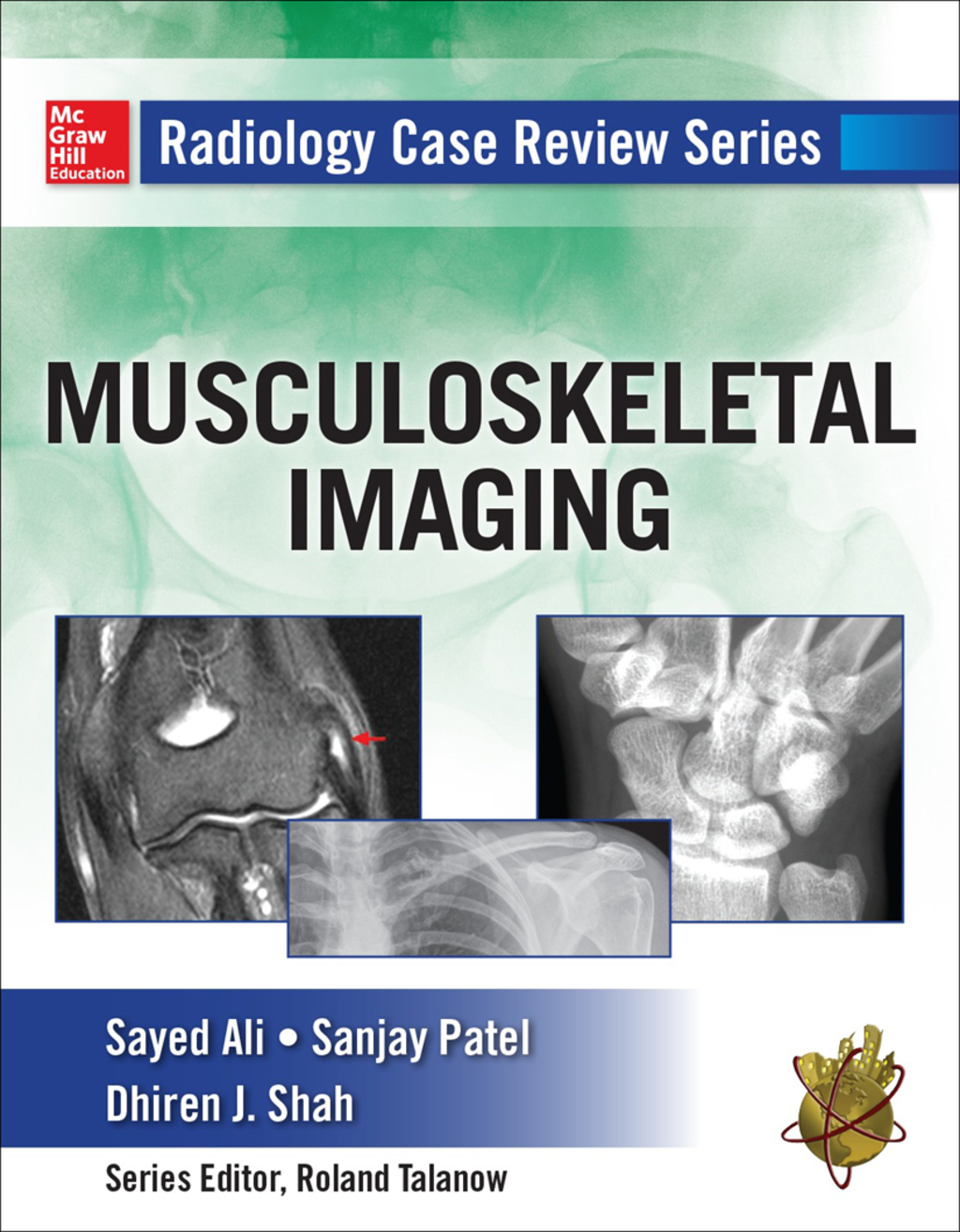 Radiology Case Review Series: MSK Imaging 1st Edition â€“ PDF/EPUB Version Downloadable