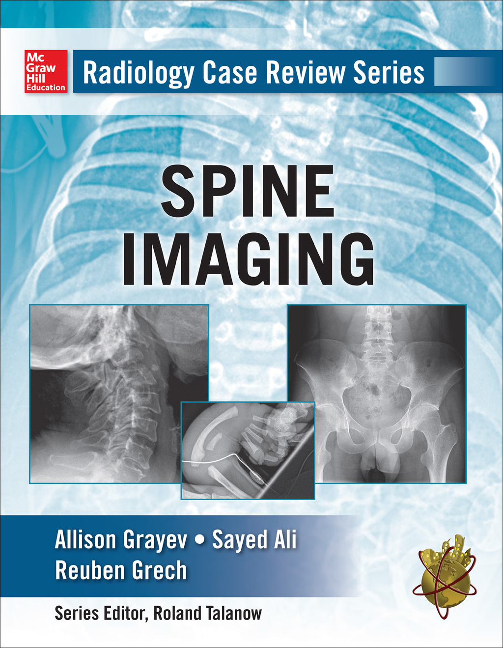 Radiology Case Review Series: Spine 1st Edition â€“ PDF/EPUB Version Downloadable